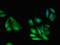 Guanine nucleotide-binding protein G(I)/G(S)/G(T) subunit beta-1 antibody, LS-C678114, Lifespan Biosciences, Immunofluorescence image 
