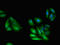 G Protein Subunit Beta 1 antibody, LS-C678114, Lifespan Biosciences, Immunofluorescence image 