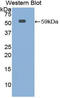 Interleukin 10 Receptor Subunit Alpha antibody, LS-C294815, Lifespan Biosciences, Western Blot image 