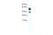 Thyroid Hormone Receptor Beta antibody, 28-321, ProSci, Western Blot image 