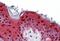 Involucrin antibody, MBS242340, MyBioSource, Immunohistochemistry paraffin image 