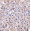 DNA Damage Regulated Autophagy Modulator 1 antibody, PA5-20335, Invitrogen Antibodies, Immunohistochemistry frozen image 