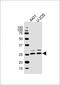 Myeloid Leukemia Factor 1 antibody, M06772, Boster Biological Technology, Western Blot image 