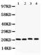 Caveolin 1 antibody, PB9165, Boster Biological Technology, Western Blot image 