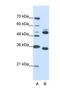 WD Repeat Domain 6 antibody, NBP1-54844, Novus Biologicals, Western Blot image 