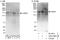 Centrosome And Spindle Pole Associated Protein 1 antibody, A303-395A, Bethyl Labs, Western Blot image 