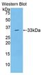 Serpin Family A Member 7 antibody, LS-C296651, Lifespan Biosciences, Western Blot image 