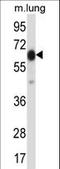 POF1B Actin Binding Protein antibody, LS-C163833, Lifespan Biosciences, Western Blot image 