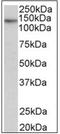 Telomerase Reverse Transcriptase antibody, AP31849PU-N, Origene, Western Blot image 