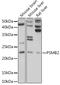 Proteasome Subunit Beta 2 antibody, GTX54633, GeneTex, Western Blot image 