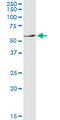 Solute Carrier Family 11 Member 1 antibody, LS-C198214, Lifespan Biosciences, Western Blot image 