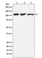 DISC1 Scaffold Protein antibody, M00750, Boster Biological Technology, Western Blot image 