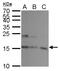 Ubiquitin Conjugating Enzyme E2 A antibody, GTX100426, GeneTex, Western Blot image 