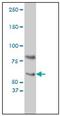 Cryptochrome Circadian Regulator 1 antibody, AM31168PU-N, Origene, Western Blot image 