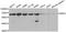 Glucose-6-Phosphate Dehydrogenase antibody, STJ23728, St John