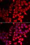 Cytidine/Uridine Monophosphate Kinase 1 antibody, LS-C334795, Lifespan Biosciences, Immunofluorescence image 