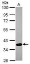 SPARC (Osteonectin), Cwcv And Kazal Like Domains Proteoglycan 3 antibody, PA5-31369, Invitrogen Antibodies, Western Blot image 