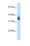 MAGE Family Member A8 antibody, NBP1-55465, Novus Biologicals, Western Blot image 