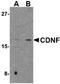 Cerebral Dopamine Neurotrophic Factor antibody, PA5-20429, Invitrogen Antibodies, Western Blot image 