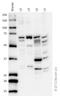 Cystathionine-Beta-Synthase antibody, ab96252, Abcam, Western Blot image 