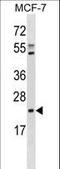 EBP Cholestenol Delta-Isomerase antibody, LS-C157701, Lifespan Biosciences, Western Blot image 