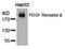 Platelet Derived Growth Factor Receptor Beta antibody, 79-586, ProSci, Western Blot image 