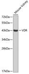 Vitamin D Receptor antibody, 18-567, ProSci, Western Blot image 