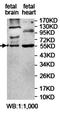 Zinc Finger Protein 223 antibody, orb78013, Biorbyt, Western Blot image 