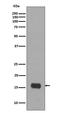 Microtubule Associated Protein 1 Light Chain 3 Alpha antibody, M01543-1, Boster Biological Technology, Western Blot image 