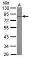 Sorbin And SH3 Domain Containing 3 antibody, NBP2-20860, Novus Biologicals, Western Blot image 