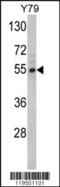 Fascin Actin-Bundling Protein 1 antibody, 62-436, ProSci, Western Blot image 