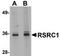 Arginine And Serine Rich Coiled-Coil 1 antibody, TA306925, Origene, Western Blot image 