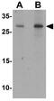 AKT1 Substrate 1 antibody, GTX31882, GeneTex, Western Blot image 