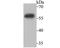 Inosine Monophosphate Dehydrogenase 2 antibody, A03021-1, Boster Biological Technology, Western Blot image 