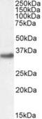 Engrailed Homeobox 2 antibody, NB100-2814, Novus Biologicals, Western Blot image 