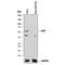 X-Linked Inhibitor Of Apoptosis antibody, MAB822, R&D Systems, Western Blot image 