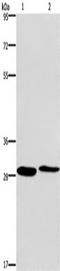 Cleavage And Polyadenylation Specific Factor 4 antibody, TA349826, Origene, Western Blot image 