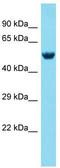 Mex-3 RNA Binding Family Member A antibody, TA334108, Origene, Western Blot image 