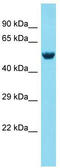 Mex-3 RNA Binding Family Member A antibody, TA334108, Origene, Western Blot image 