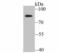 Bradykinin Receptor B2 antibody, NBP2-75421, Novus Biologicals, Western Blot image 