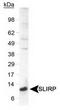 SRA Stem-Loop Interacting RNA Binding Protein antibody, TA309873, Origene, Western Blot image 