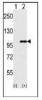 Inositol Polyphosphate-5-Phosphatase D antibody, AP12504PU-N, Origene, Western Blot image 