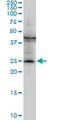 Glutathione S-transferase Mu 2 antibody, LS-B6092, Lifespan Biosciences, Western Blot image 