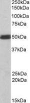 C-Terminal Src Kinase antibody, MBS421145, MyBioSource, Western Blot image 