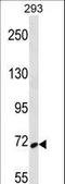 Spleen Associated Tyrosine Kinase antibody, LS-C161635, Lifespan Biosciences, Western Blot image 