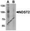 N-Deacetylase And N-Sulfotransferase 2 antibody, 7869, ProSci, Western Blot image 