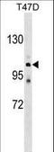 Calcium-transporting ATPase type 2C member 1 antibody, LS-C159138, Lifespan Biosciences, Western Blot image 