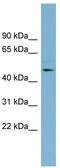 Trimethyllysine Hydroxylase, Epsilon antibody, TA344913, Origene, Western Blot image 