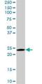 RAB6A, Member RAS Oncogene Family antibody, H00005870-M01, Novus Biologicals, Western Blot image 