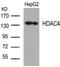 Histone Deacetylase 4 antibody, AP02668PU-S, Origene, Western Blot image 